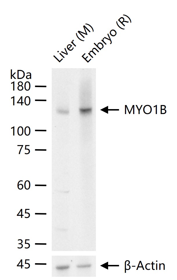 肌球蛋白1B重组兔单抗-bsm-62726R