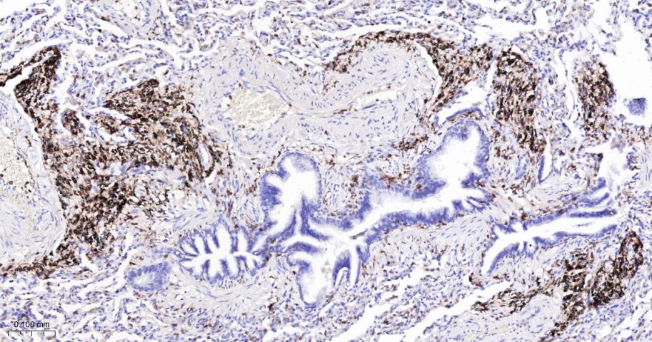 小鼠抗人CD18单克隆抗体-bsm-30018M