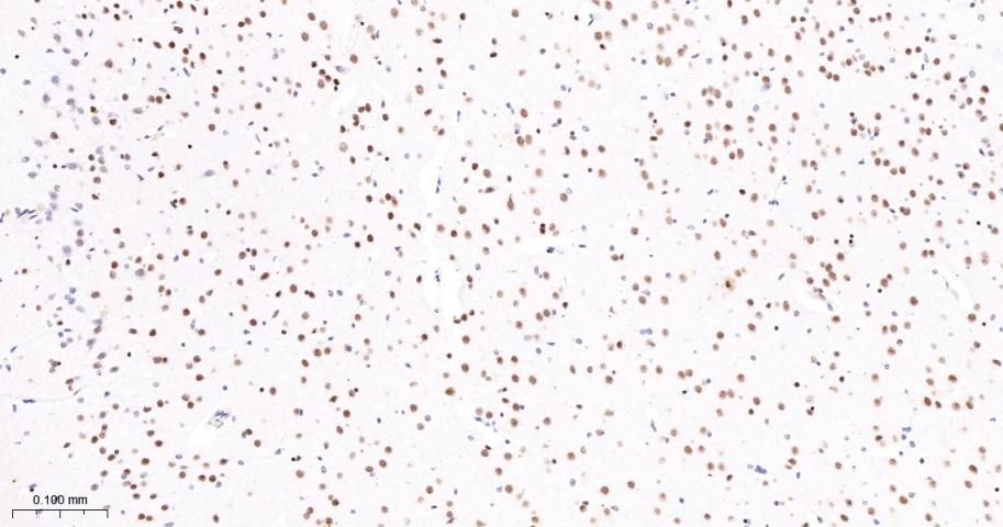 转录因子7类似物2重组兔单抗-bsm-52543R