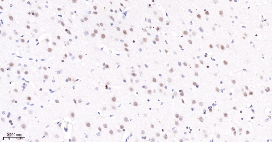 转录因子7类似物2重组兔单抗-bsm-52543R