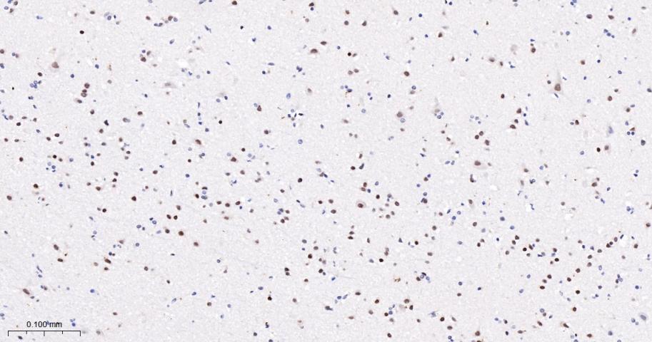 转录因子7类似物2重组兔单抗-bsm-52543R