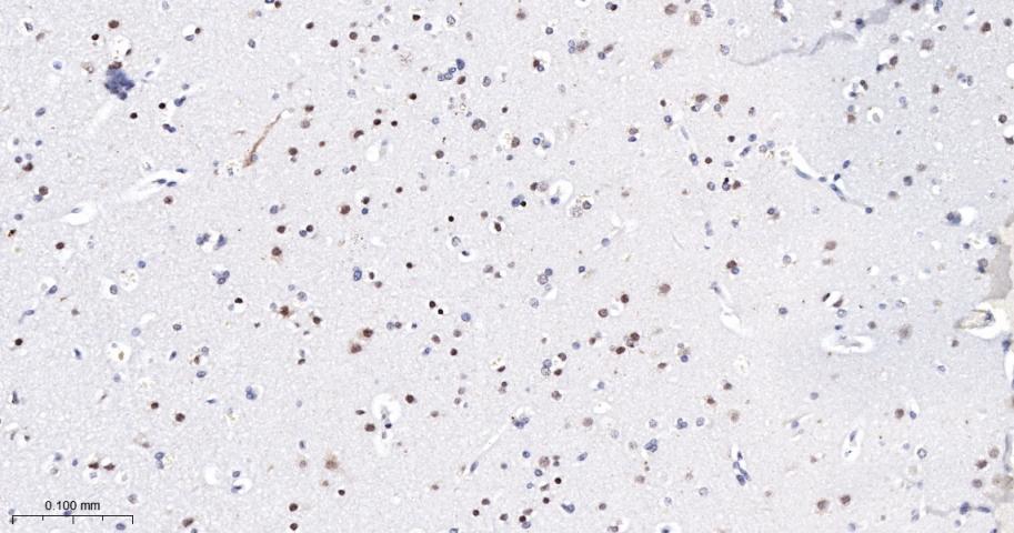 转录因子7类似物2重组兔单抗-bsm-52543R