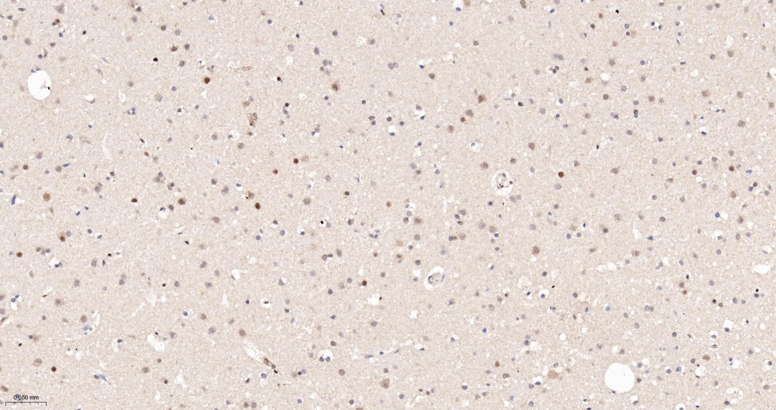 缺氧诱导因子1α抑制蛋白/HIF1AN重组兔单抗-bsm-61905R