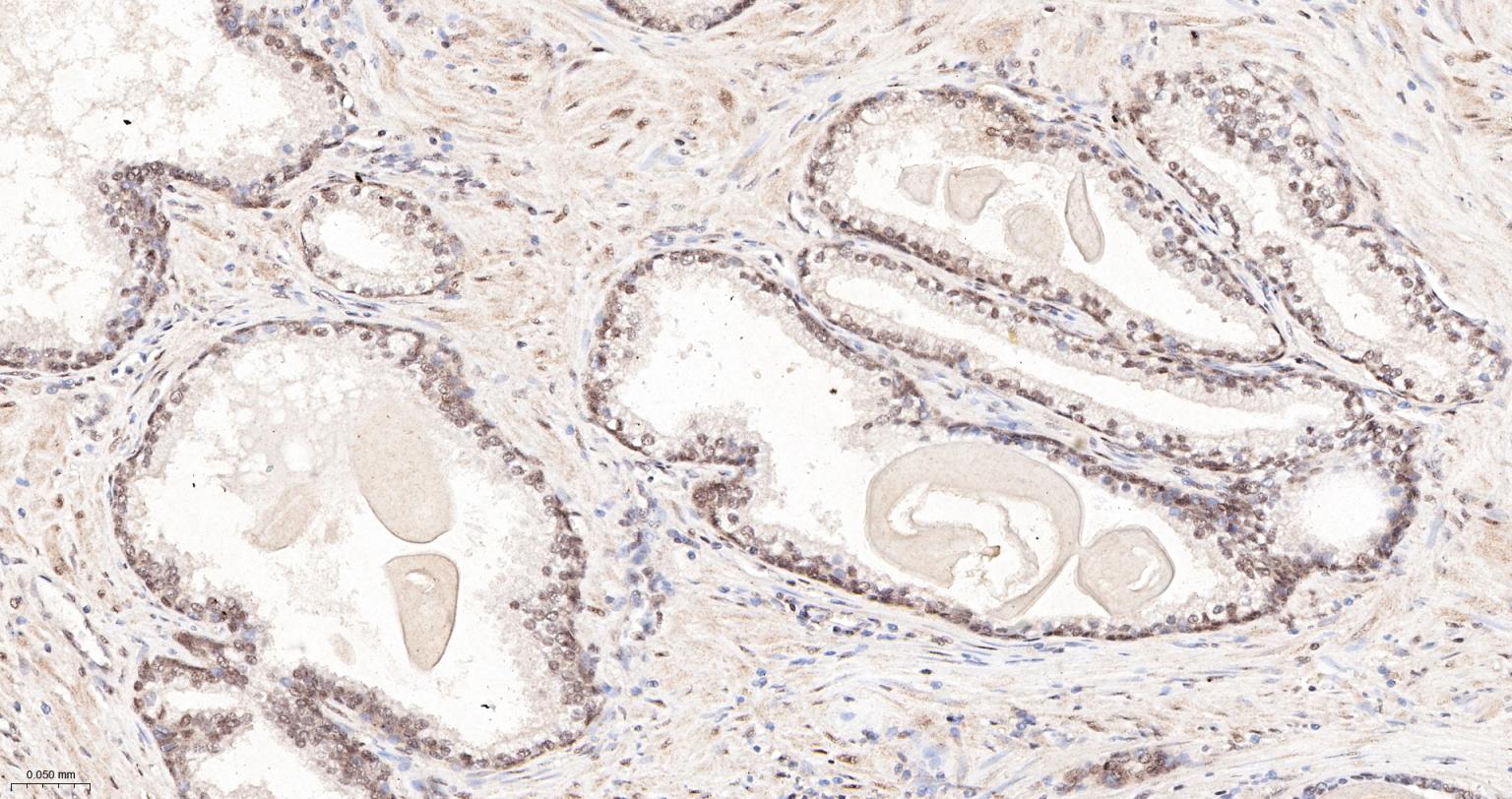 缺氧诱导因子1α抑制蛋白/HIF1AN重组兔单抗-bsm-61905R