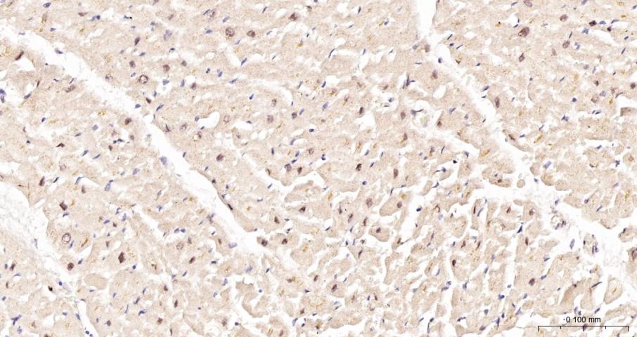 缺氧诱导因子1α抑制蛋白/HIF1AN重组兔单抗-bsm-61905R