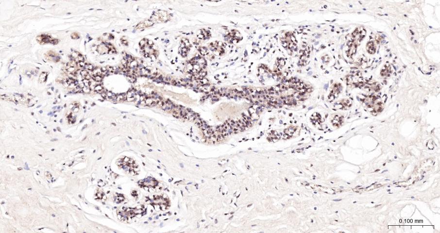 缺氧诱导因子1α抑制蛋白/HIF1AN重组兔单抗-bsm-61905R