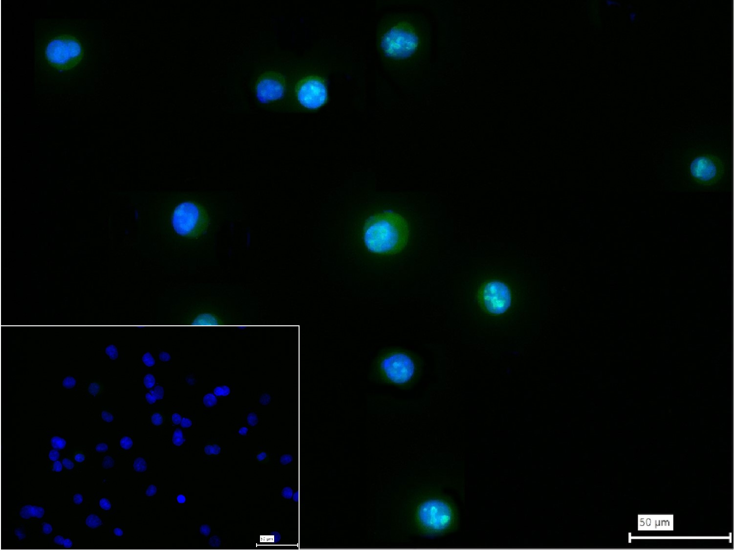 着丝粒蛋白C1重组兔单抗-bsm-54360R