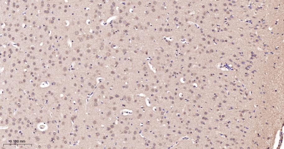 肿瘤易感基因101蛋白抗体-bsm-52746R