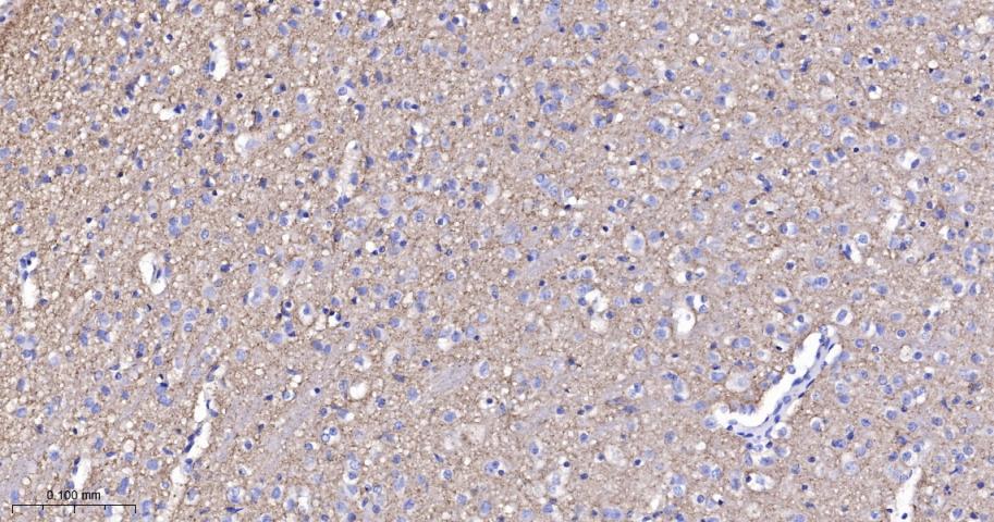 神经突触素2重组兔单抗-bsm-54672R