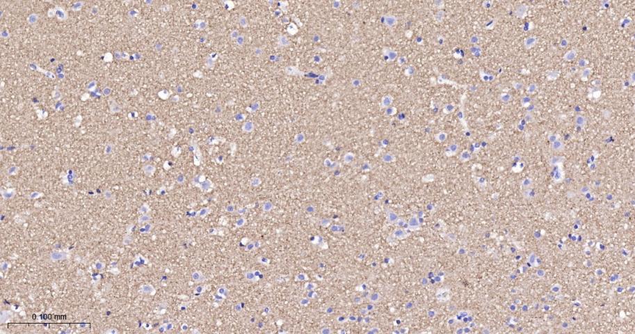 神经突触素2重组兔单抗-bsm-54672R