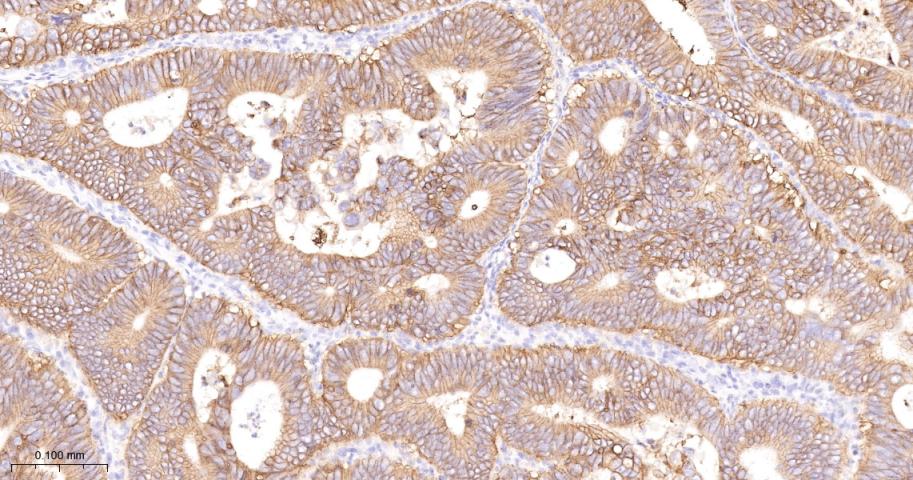 CD46重组兔多克隆抗体-bsm-54335R