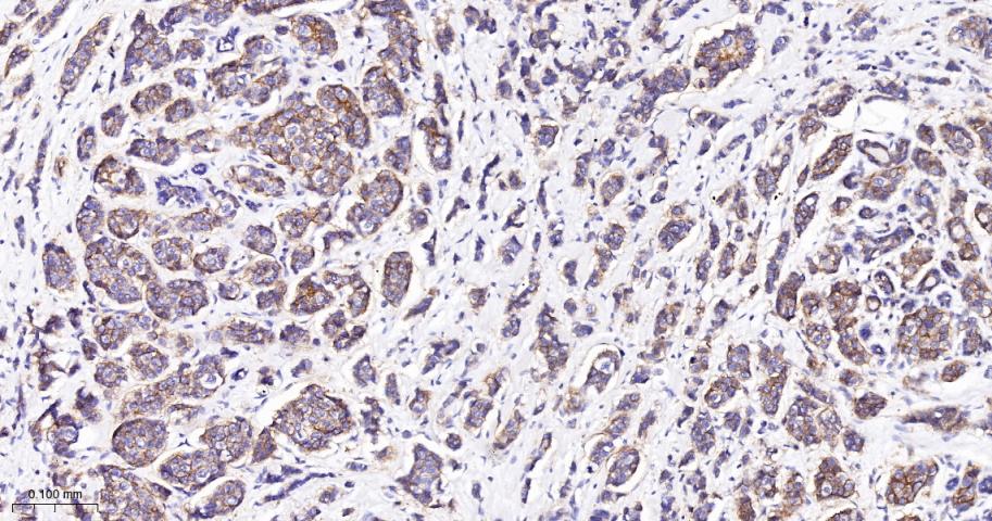 CD46重组兔多克隆抗体-bsm-54335R
