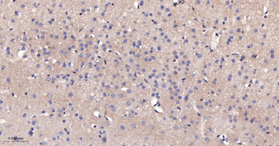 β-连环蛋白/β-连环素/β链接素重组兔单抗-bsm-55526R