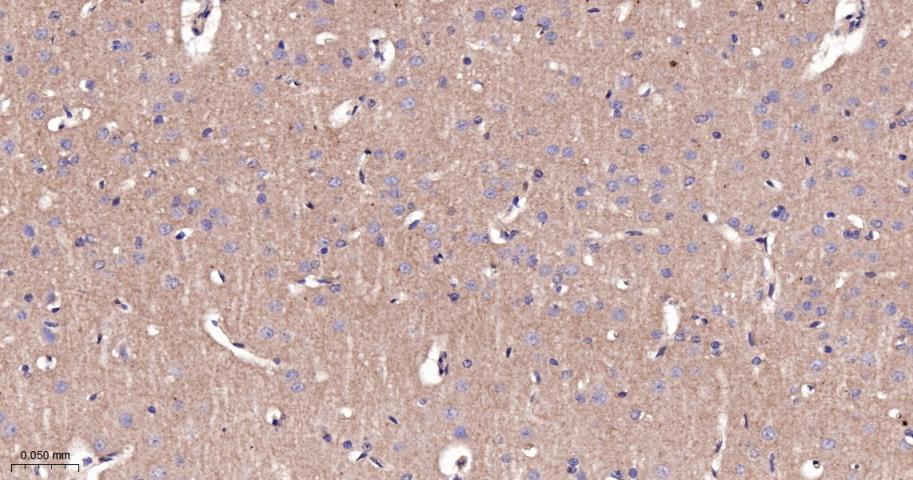 β-连环蛋白/β-连环素/β链接素重组兔单抗-bsm-55526R