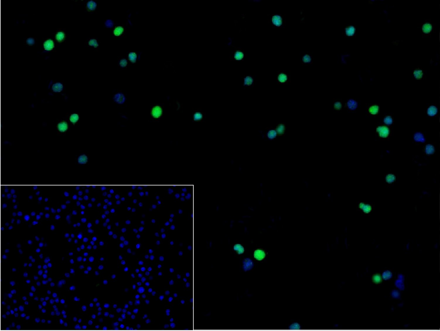 周期素E2重组兔单抗-bsm-52049R