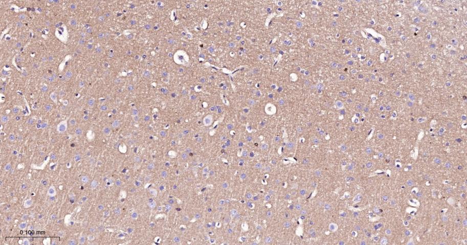 朊病毒蛋白CD230重组兔单抗-bsm-52505R