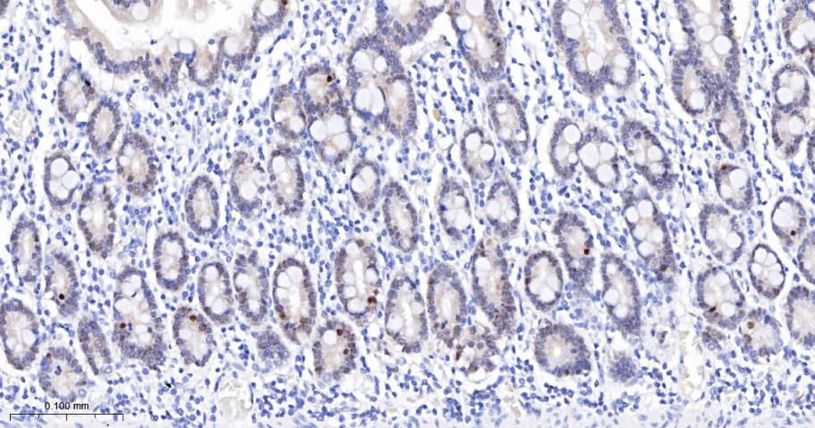 胰岛素促进因子重组兔单抗-bsm-54153R