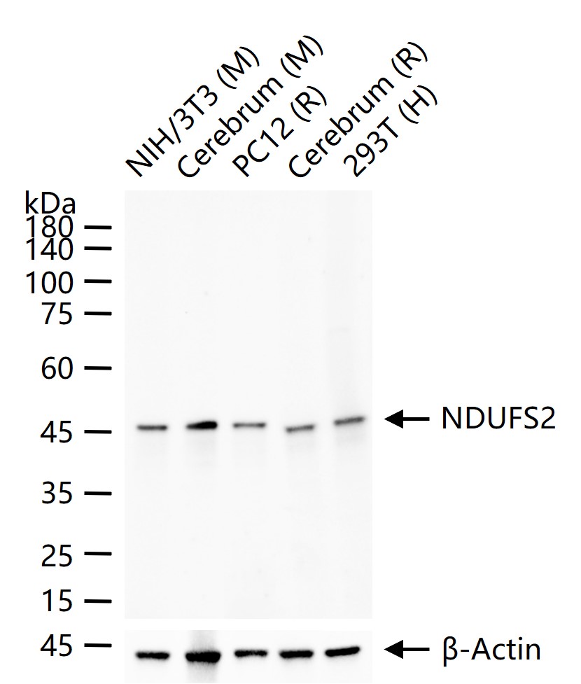 NDUFS2重组兔单抗-bsm-62748R