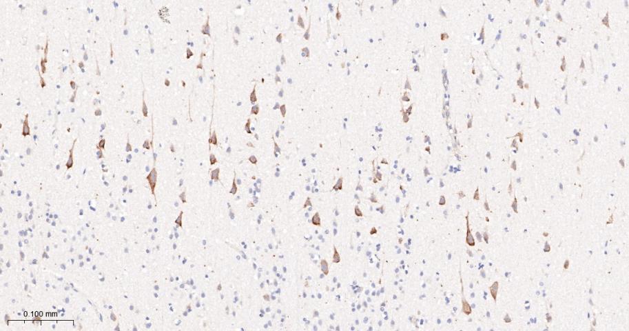磷酸化叉头蛋白3A重组兔单抗-bsm-52156R