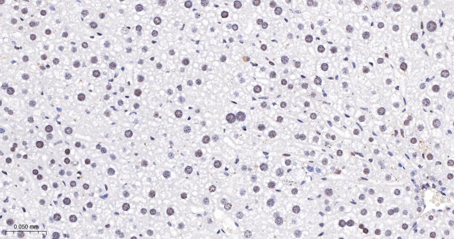 磷酸化蛋白激酶C α/β2重组兔单抗-bsm-52187R