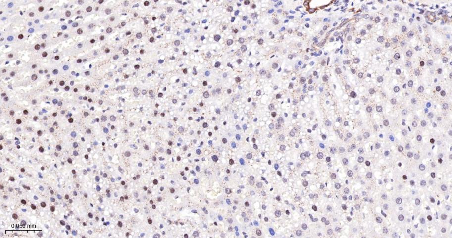 磷酸化蛋白激酶C α/β2重组兔单抗-bsm-52187R