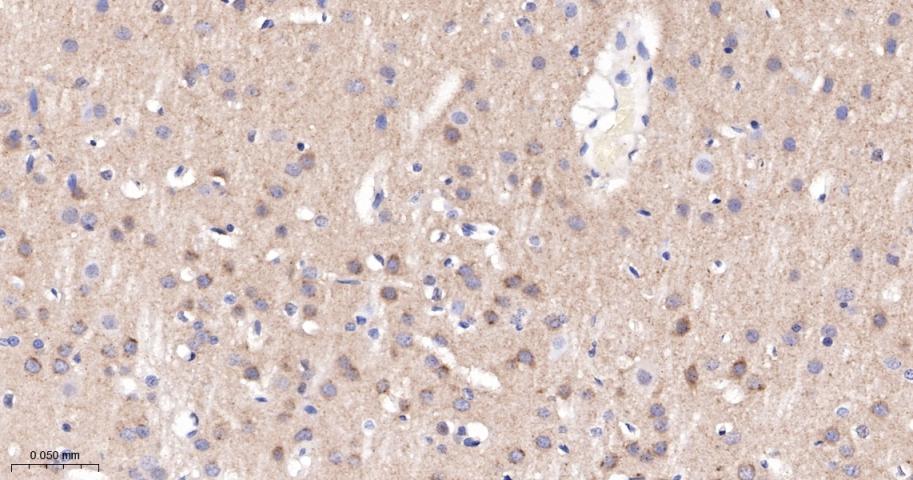 磷酸化蛋白激酶C α/β2重组兔单抗-bsm-52187R