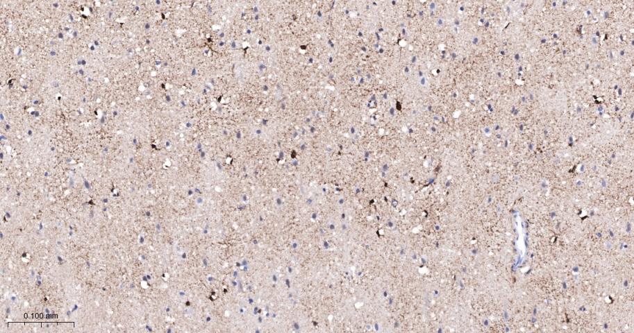 磷酸化蛋白激酶C α/β2重组兔单抗-bsm-52187R