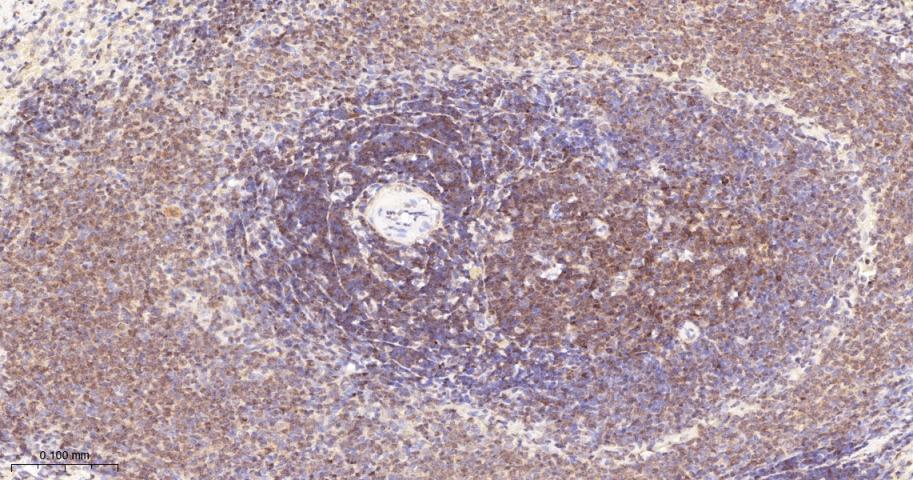 磷酸化蛋白激酶C α/β2重组兔单抗-bsm-52187R