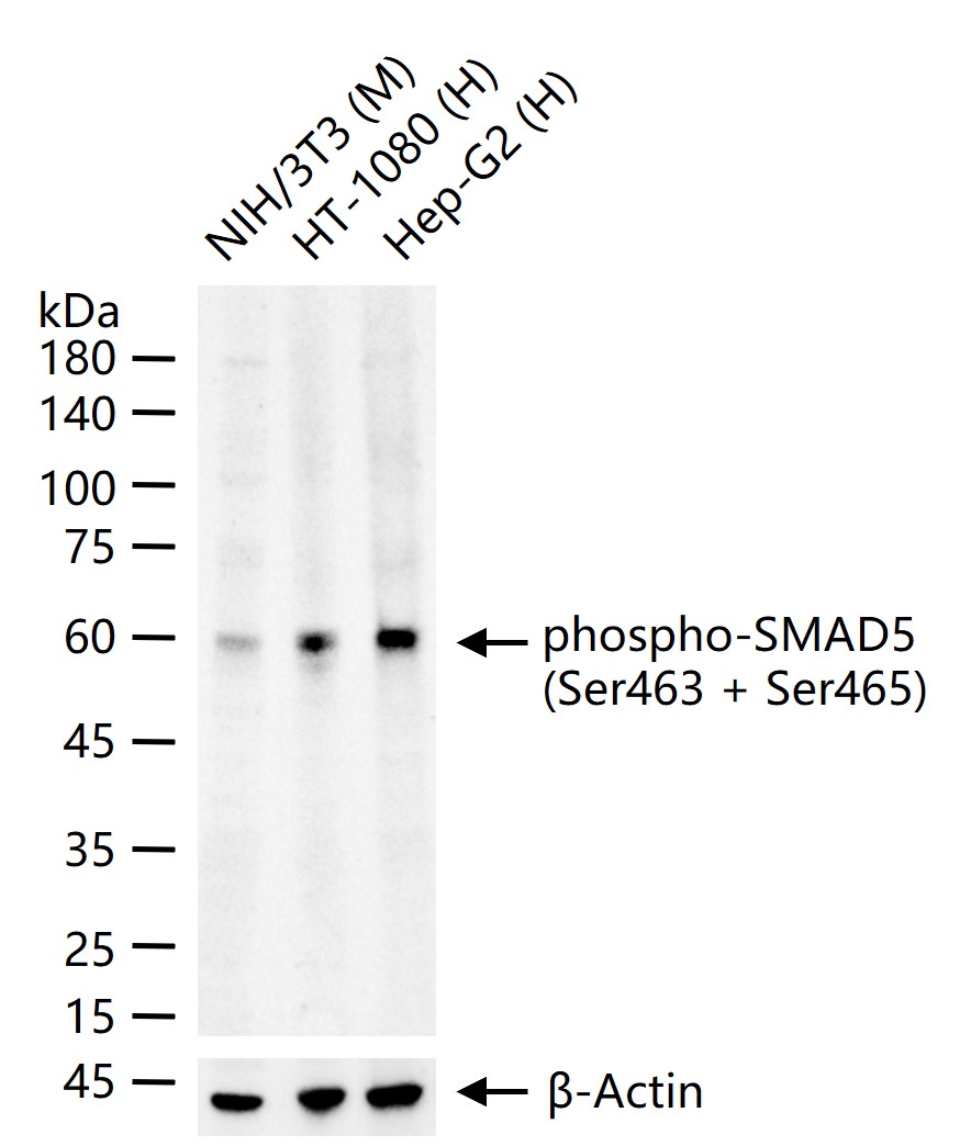 磷酸化细胞信号转导分子SMAD5重组兔单抗-bsm-52206R