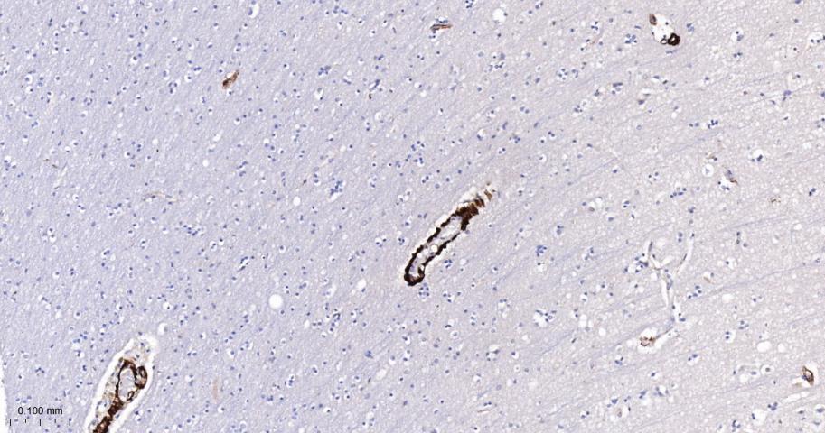 细胞骨架相关蛋白重组兔单抗-bsm-61818R