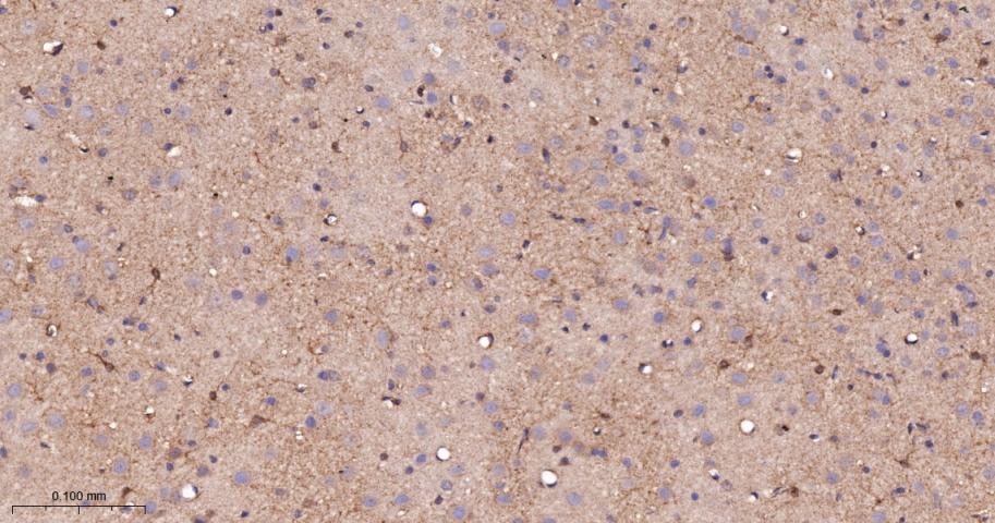 蛋白激酶C-δ/θ重组兔单抗-bsm-62953R