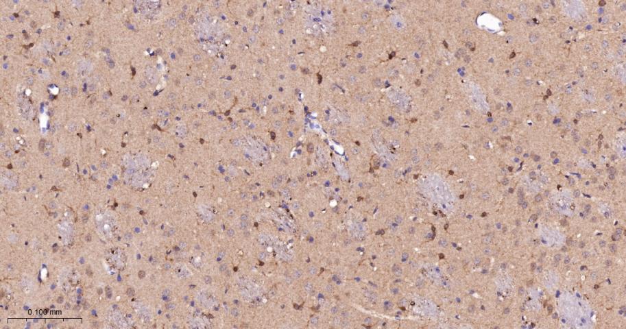 蛋白激酶C-δ/θ重组兔单抗-bsm-62953R
