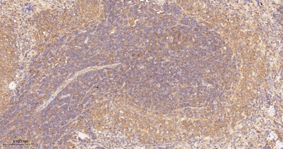 蛋白激酶C-δ/θ重组兔单抗-bsm-62953R