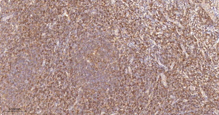 蛋白激酶C-δ/θ重组兔单抗-bsm-62953R