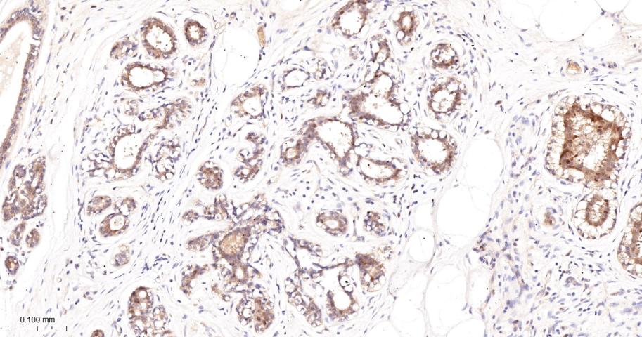 蛋白激酶C-δ/θ重组兔单抗-bsm-62953R