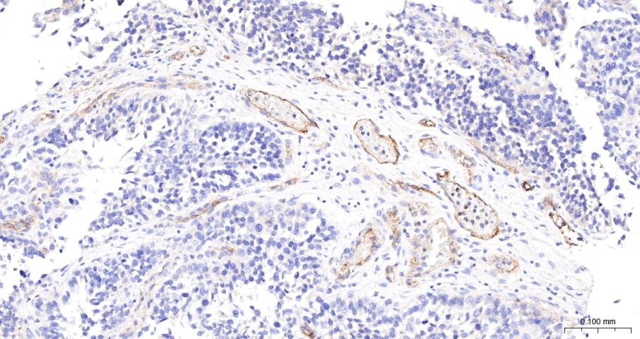 CD59重组兔单抗-bsm-60603R