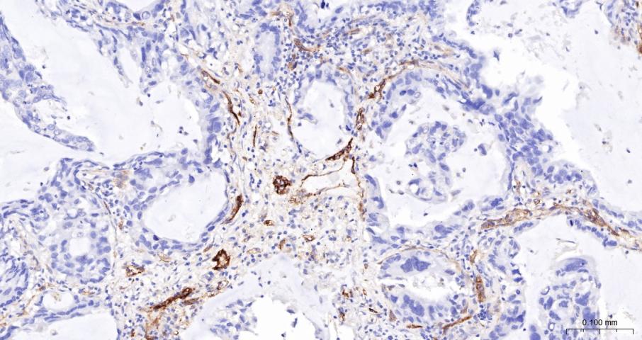 CD59重组兔单抗-bsm-60603R