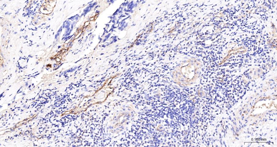 CD59重组兔单抗-bsm-60603R