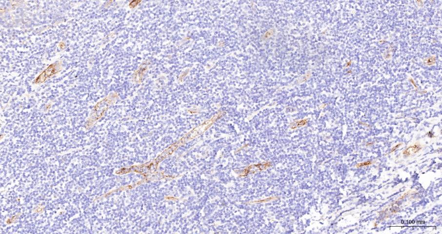 CD59重组兔单抗-bsm-60603R