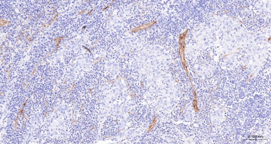 CD59重组兔单抗-bsm-60603R