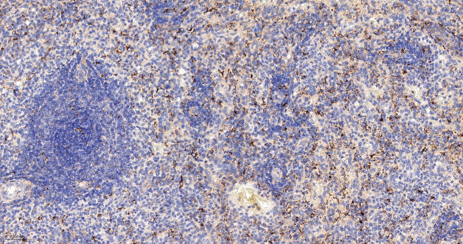巨噬细胞克隆刺激因子重组兔单抗-bsm-61014R