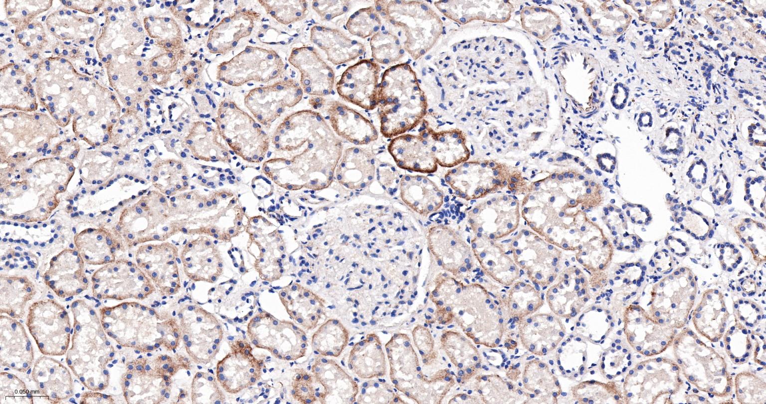 巨噬细胞克隆刺激因子重组兔单抗-bsm-61014R