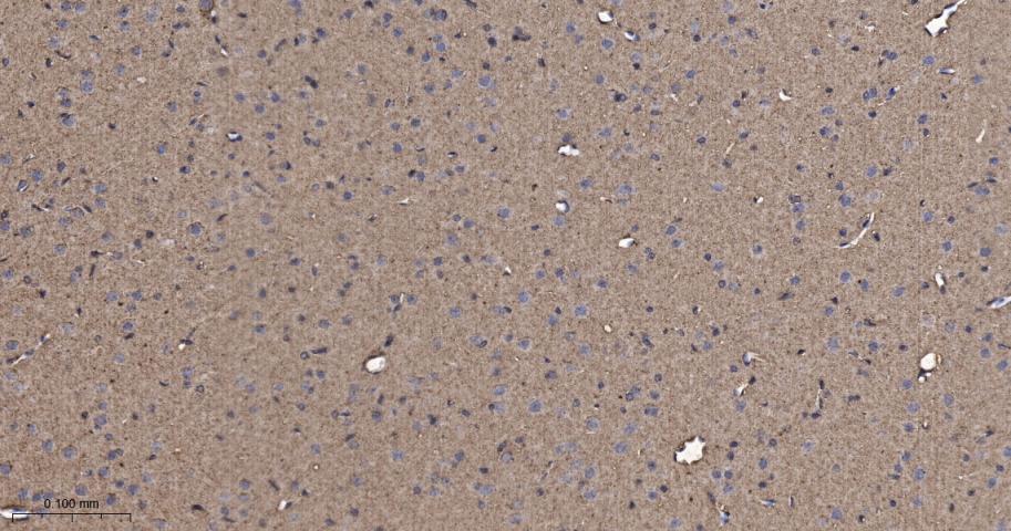 原癌基因Ras重组兔单抗-bsm-62921R