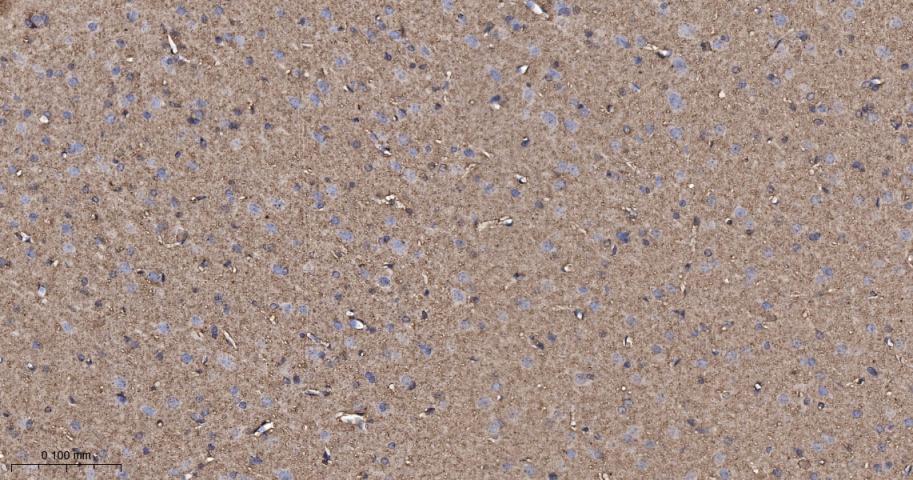 原癌基因Ras重组兔单抗-bsm-62921R