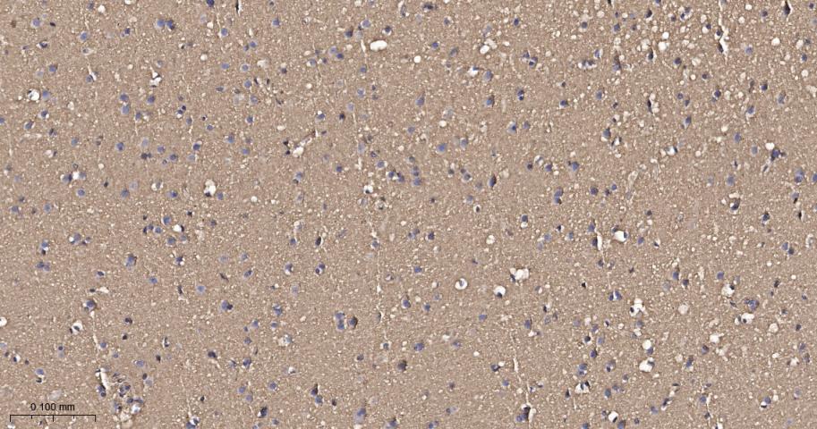 原癌基因Ras重组兔单抗-bsm-62921R