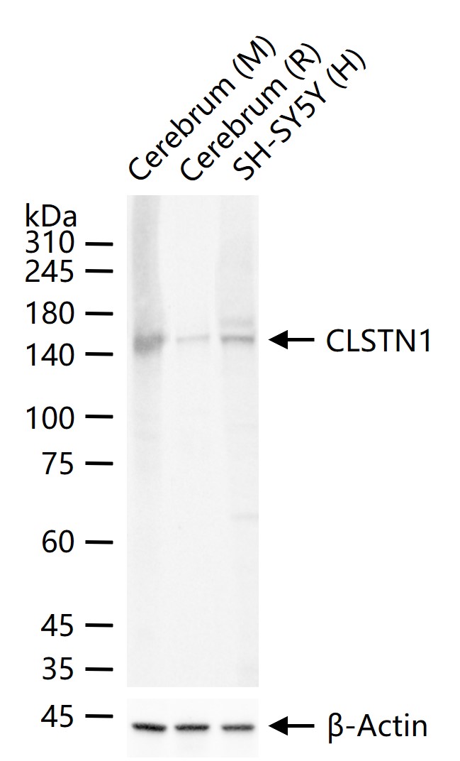 老年痴呆相关类钙粘蛋白CS1重组兔单抗-bsm-62063R