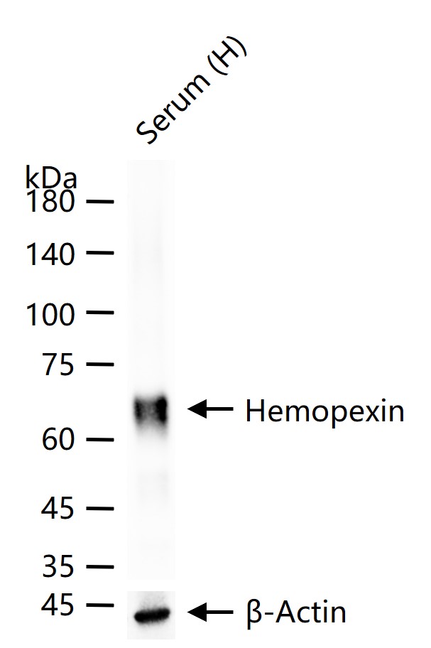 糖蛋白β-1B重组兔单抗-bsm-61636R