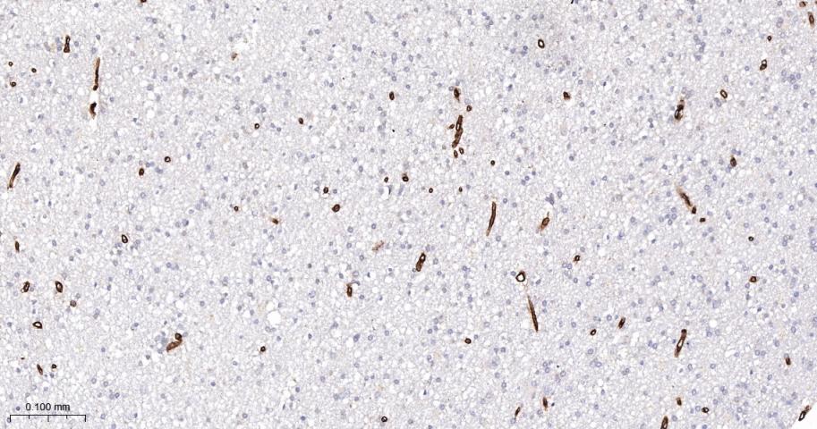 IV型胶原蛋白重组兔单抗-bsm-56208R