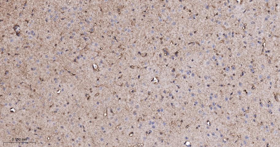 p21激活激酶2重组兔单抗-bsm-61673R