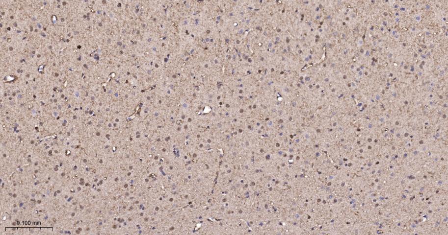p21激活激酶2重组兔单抗-bsm-61673R